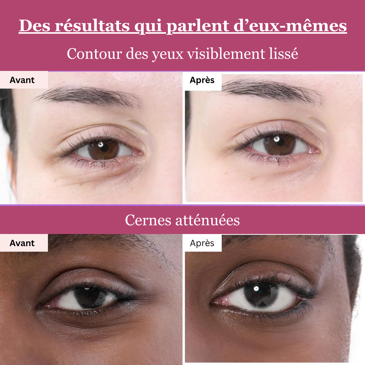 NUMBUZIN NAD+ Collagen Under Eye Patches
